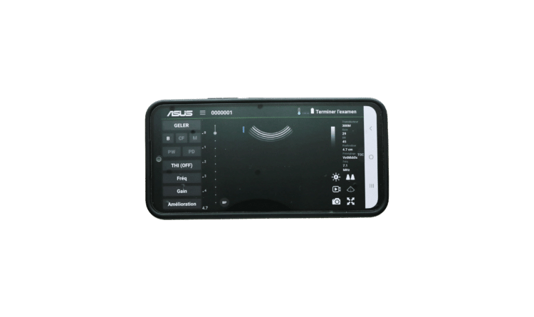 logiciel échographe portable sur téléphone portable