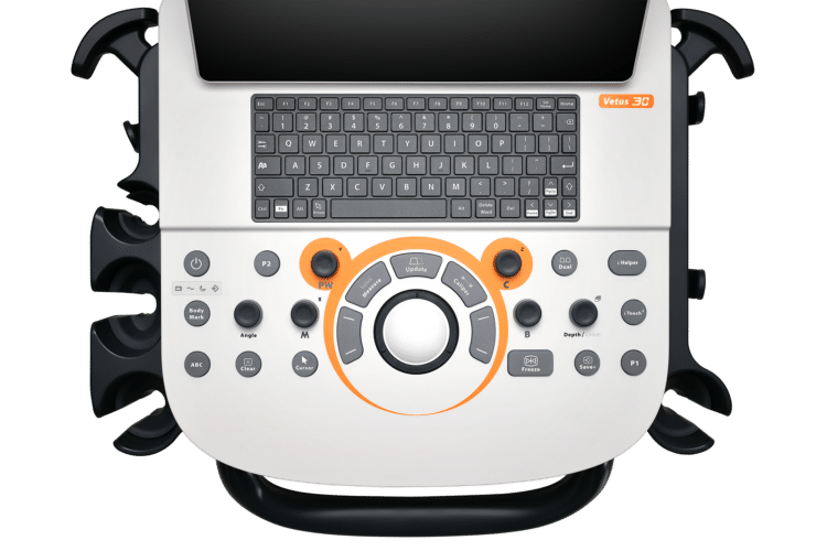 Vue de dessus du panneau de commande du Mindray Vetus 30 avec clavier, boutons de fonction, molettes de réglage et commande centrale entourée d’un repère orange.